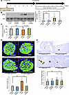 Suppression of the hepatic ERK pathway blunts β cell proliferation in mice