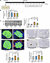 Blockade of the neuronal relay by pharmacologically blocking the afferent s