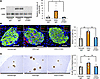 Blockade of colonic inflammation suppresses hepatic ERK activation and β ce