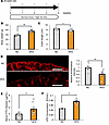 Colonic inflammation was induced in mice with HFD-induced obesity.
