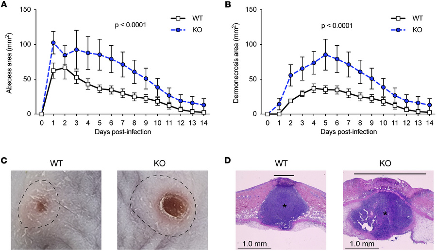LAIR1 is protective in S. aureus skin infection.
WT and Lair1-KO mice we...
