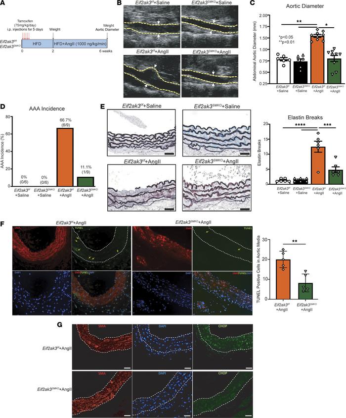 VSMC-specific PERK depletion prevents AngII-induced AAA development.
(A)...