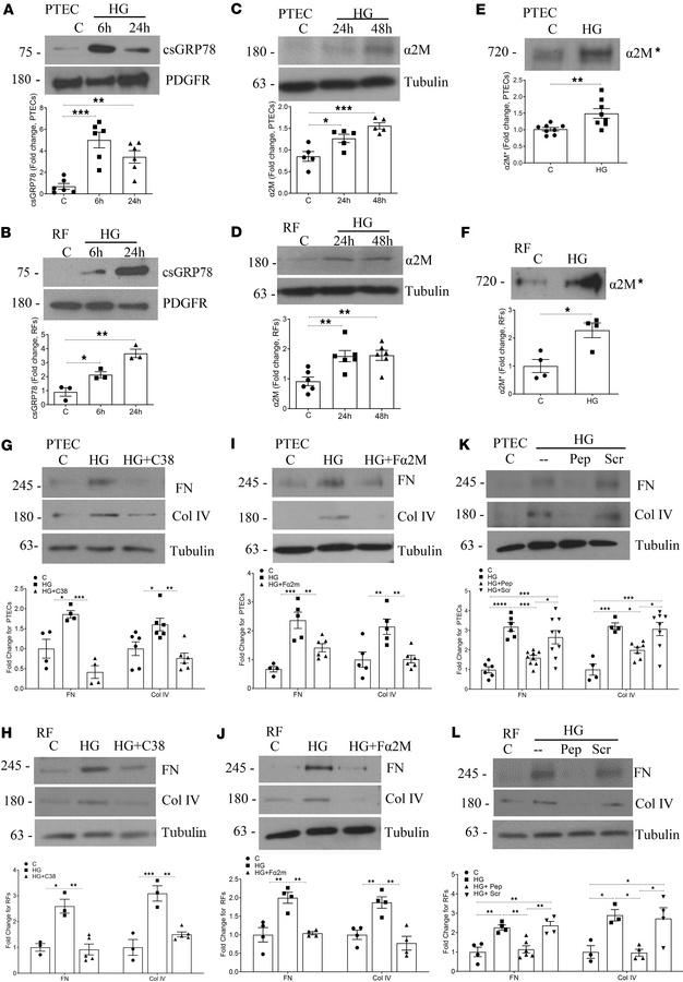 Inhibition of csGRP78 or α2M* prevents high glucose–induced matrix produ...