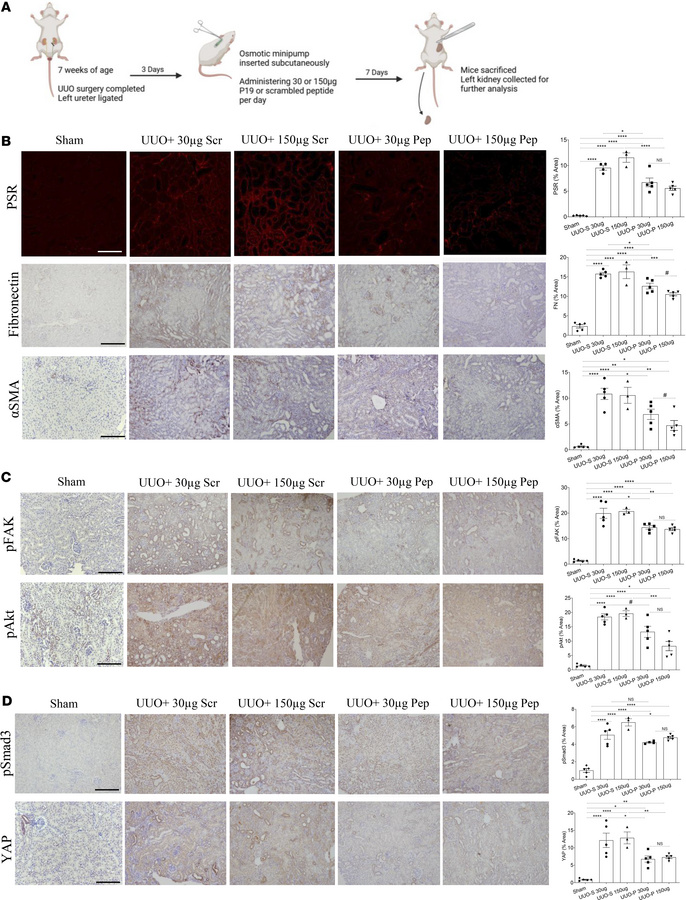 Treatment with a peptide inhibitor of csGRP78/α2M* interaction reduces f...
