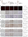 Treatment with a peptide inhibitor of csGRP78/α2M* interaction reduces fibr