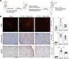 Delayed treatment with a peptide inhibitor of csGRP78/α2M* interaction redu