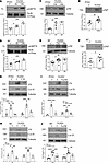TGF-β1 induces csGRP78 localization and α2M activation in PTEC and renal fi