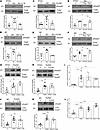 Smad3 activation by high glucose, but not by TGF-β1, is mediated by csGRP78