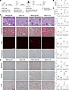 A csGRP78 neutralizing antibody attenuates fibrotic signaling in a mouse mo
