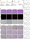Inhibition of α2M* with the Fα2M neutralizing antibody attenuates fibrotic