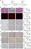 Inhibition of α2M* with the Fα2M neutralizing antibody reduces fibrosis in
