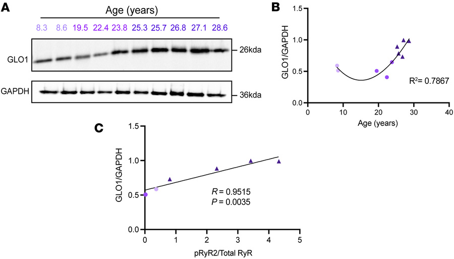 GLO1 expression increases with age and correlates with p-S2808-RyR2 in t...