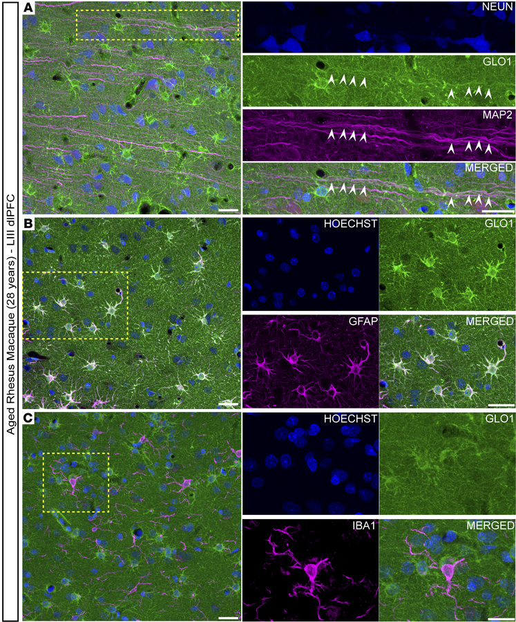 GLO1 cellular localization in the aged macaque LIII dlPFC.
Representativ...