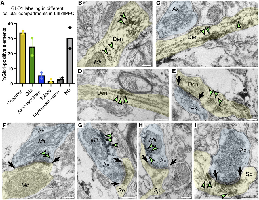 GLO1 immunoEM localization in neuronal compartments in LIII dlPFC of age...