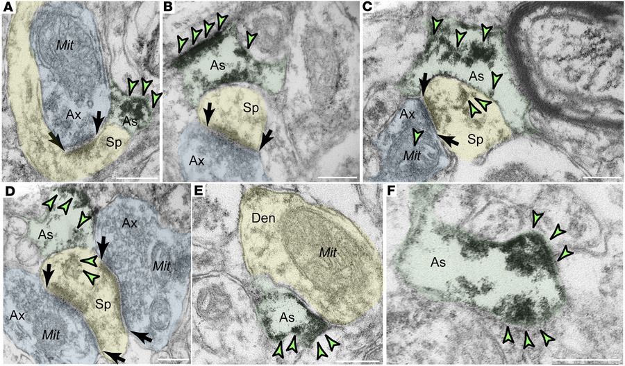 GLO1 immunoEM localization in glial processes in aged macaque LIII dlPFC...