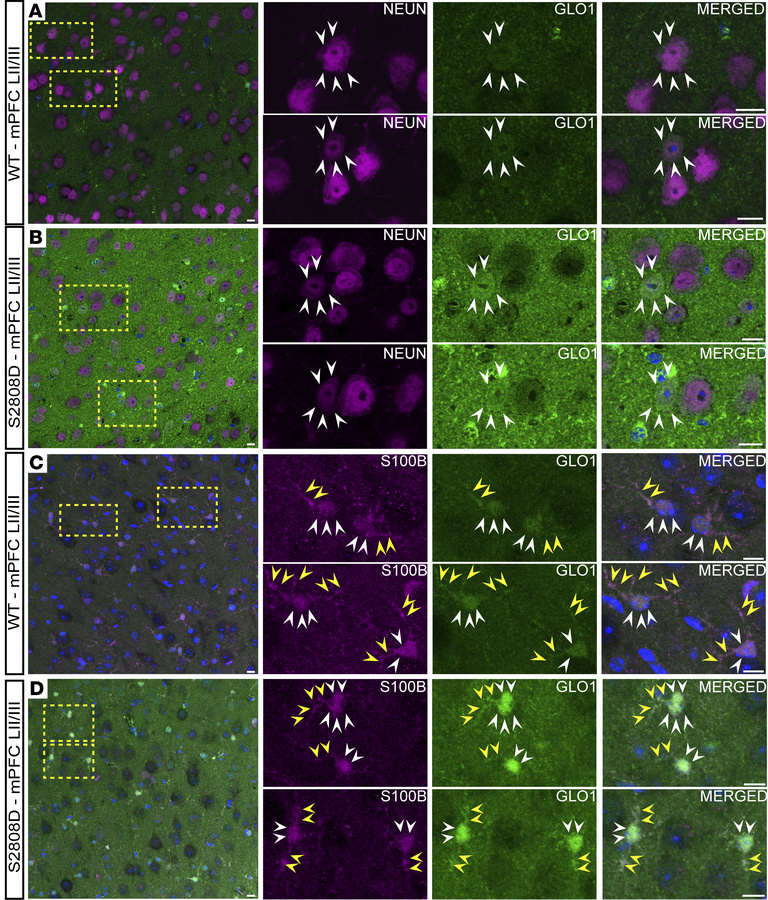 GLO1 localization in murine medial prefrontal cortex.
Representative con...
