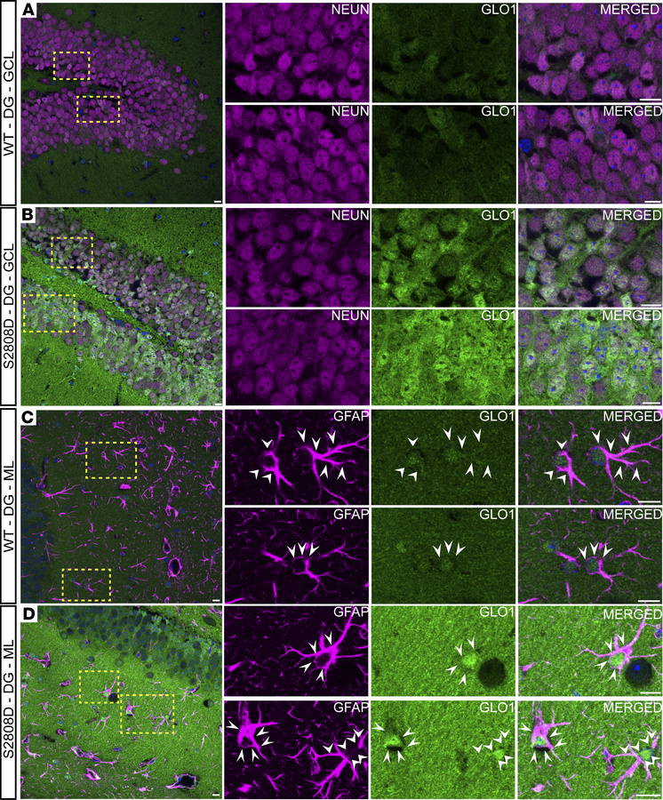 GLO1 localization in murine dentate gyrus.
Representative confocal image...