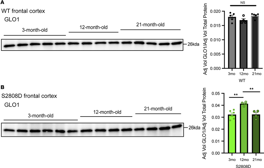 GLO1 expression follows a bell-shaped curve with age in S2808D-RyR2 fron...