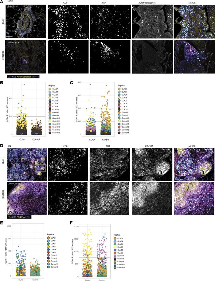 CLAD lungs and HLNs contain increased clusters of CD8+ T cells.
(A) Repr...