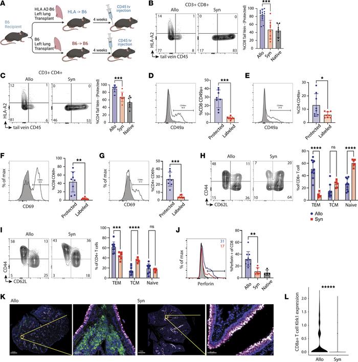 A murine model of orthotopic lung transplantation recapitulates enhanced...