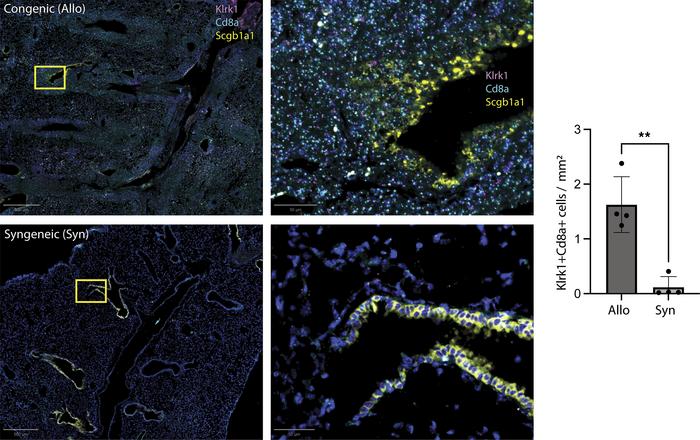 Accumulation of airway-centered Klrk1+ CD8+ cells in murine chronic reje...