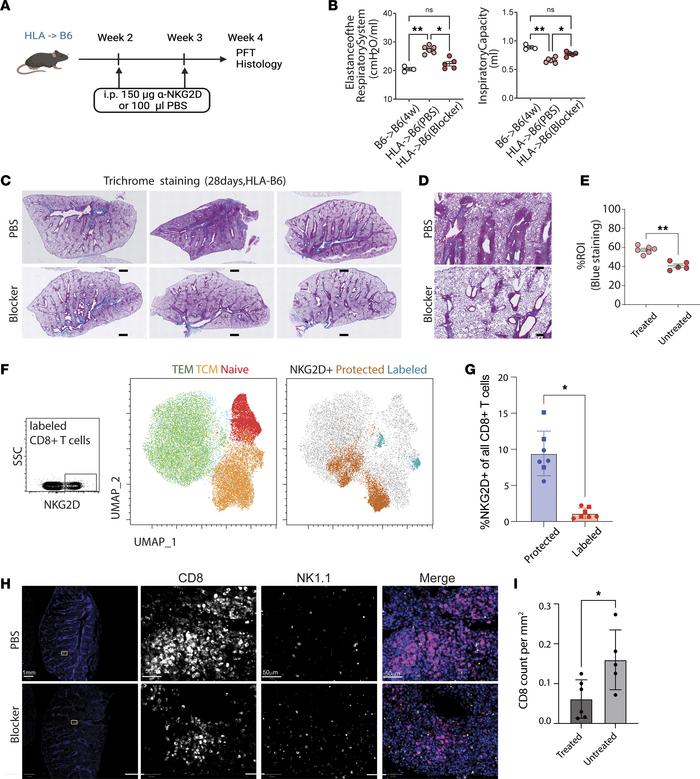 NKG2D blockade attenuates pathophysiologic changes in murine model of CL...