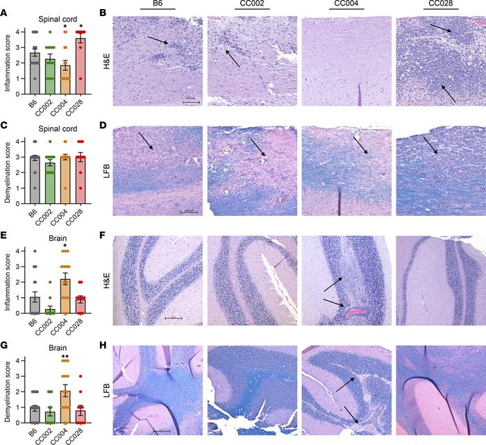 Severe progressive EAE in CC028 mice and AR-EAE in CC004 mice is associa...