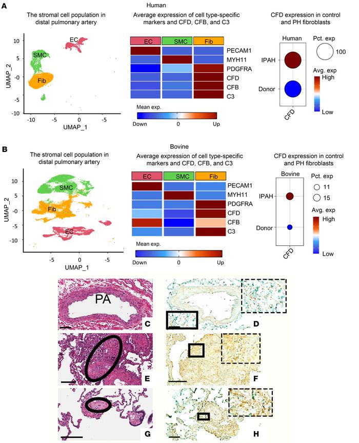 In vivo, PA fibroblasts in PAs of patients with IPAH and PH calves exhib...