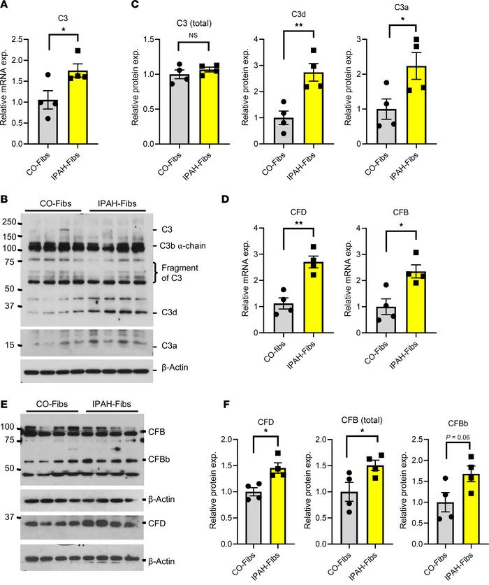 Human IPAH fibroblasts exhibit elevated expression of complement genes (...