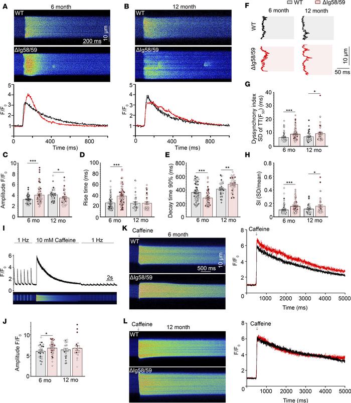 Atrial cardiomyocytes from sedentary Obscn-ΔIg58/59 mice exhibit age-spe...