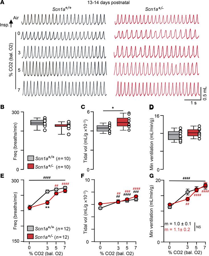 Two-week-old Scn1a+/– mice show a blunted ventilatory response to modera...