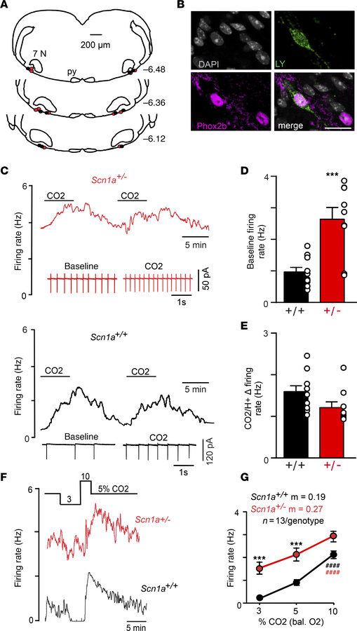 RTN neurons in slices from Scn1a+/– mice are hyperexcitable under contro...