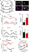 RTN neurons in slices from Scn1a+/– mice are hyperexcitable under control c