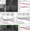 PPP inhibition in CD8+ T cells prevents antigen-specific antineuronal cytot