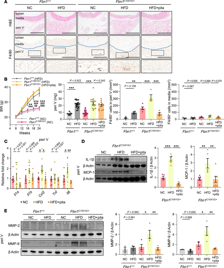 Inflammation in PVAT induced by metabolic stress accelerated aortic dila...