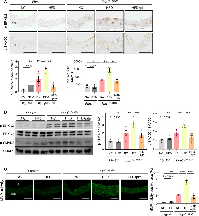 TGF-β downstream changes in the aorta of Fbn1C1041G/+ mice induced by PV...