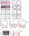 The periaortic inflammatory response of MFS mice and patients.