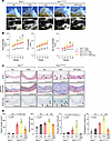 Pathological changes in the aorta of Fbn1C1041G/+ mice induced by PVAT infl
