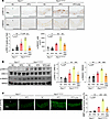 TGF-β downstream changes in the aorta of Fbn1C1041G/+ mice induced by PVAT