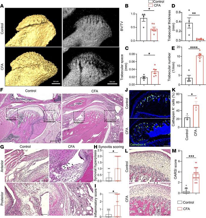 TMJ OA-like defects in CFA intra-articular injection mice.
(A) Micro-CT ...
