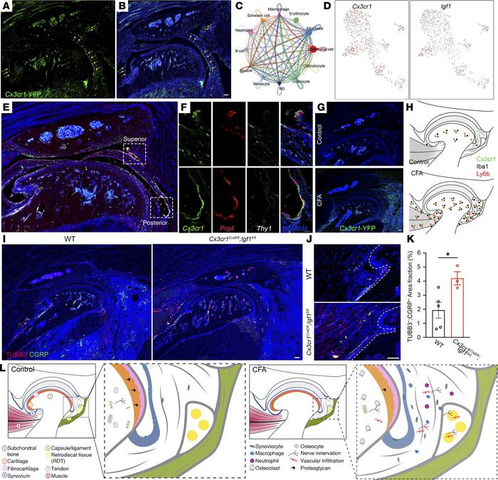 The functional importance of Igf1 signaling in barrier macrophages in TM...