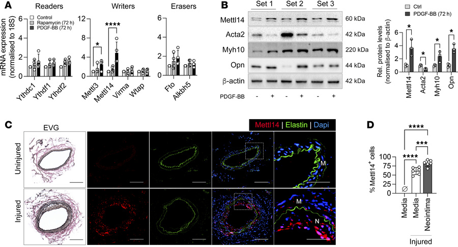 Mettl14 expression is increased in dedifferentiated VSMCs in vitro and f...