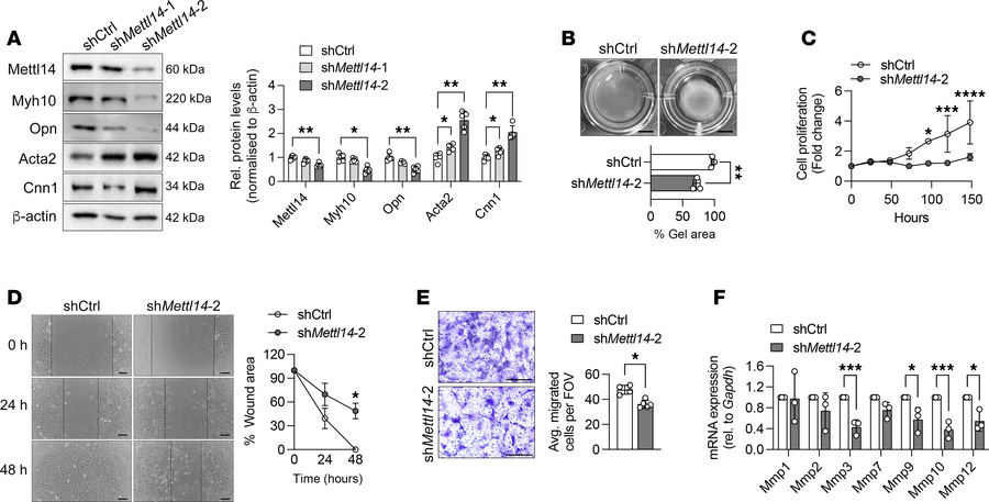 Mett14 silencing promotes VSMC differentiation in vitro.
(A) Representat...
