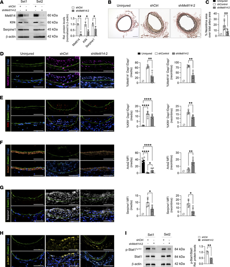 Knockdown of Mettl14 significantly reduced neointima formation in a muri...