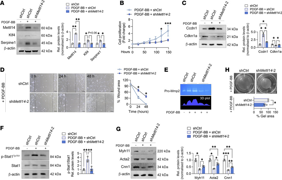 Mettl14 silencing suppresses injury-induced VSMC dedifferentiation in vi...