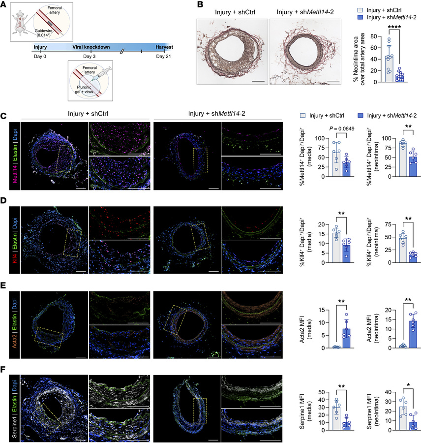 Injury-induced neointima formation can be prevented with early Mettl14 s...