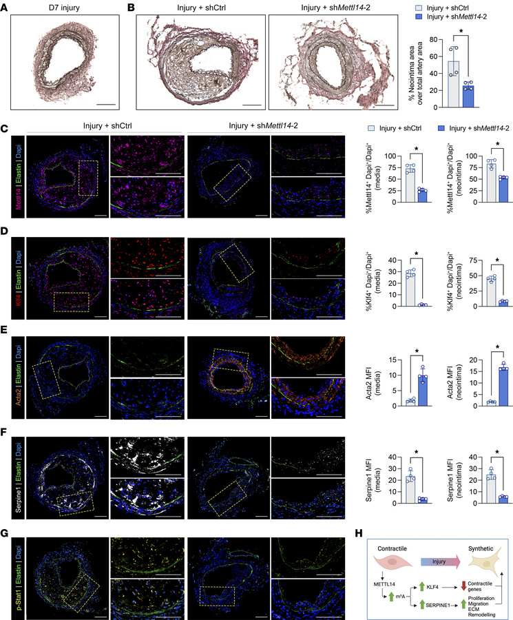 Knockdown of Mettl14 can rescue intimal hyperplasia.
(A) Representative ...