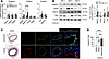Mettl14 expression is increased in dedifferentiated VSMCs in vitro and foll