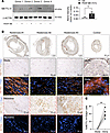 Increased METTL14 expression in the neointima of human restenotic samples.