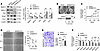 Mett14 silencing promotes VSMC differentiation in vitro.